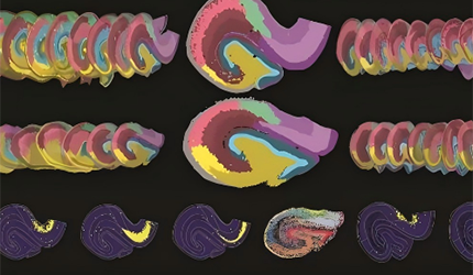 徐春組揭示海馬腦區(qū)結(jié)構(gòu)與細(xì)胞類型的進(jìn)化規(guī)律